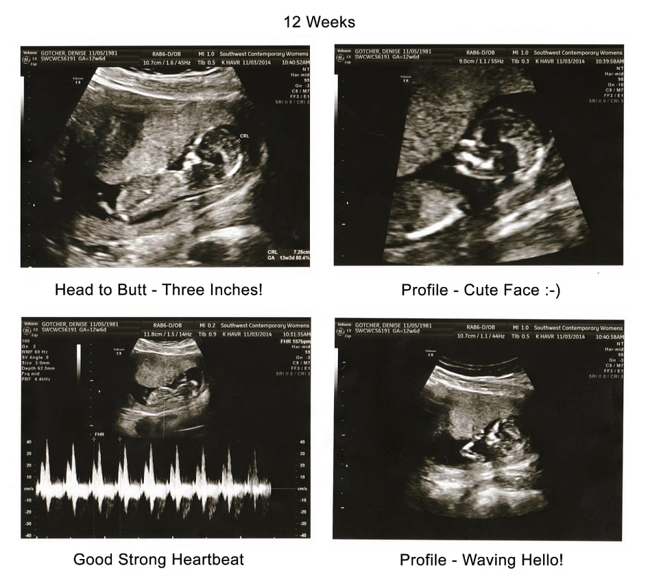 Baby G 12 Week Ultrasound 11.3.14